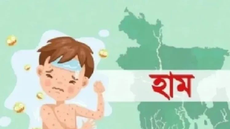 দেশে হামের উপসর্গ নিয়ে আরও ৭ জনের মৃত্যু, আক্রান্ত বাড়ছে